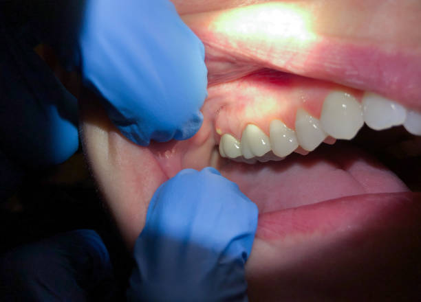 Best Emergency Cosmetic Dentistry (e.g., broken veneers) in Start, LA